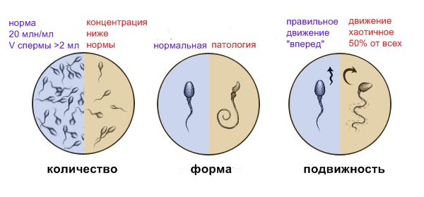 Спермограмма в МЦ «Оксфорд Медикал Днепропетровск»