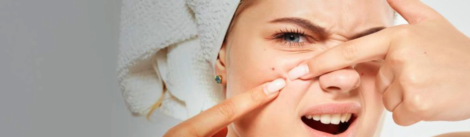 Лечение вульгарных угрей